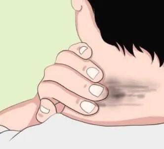 皮肤是人体自带的血糖仪？应急总医院内分泌科主任医师王凯亮介绍说，皮肤作为人体最大的器官，其健康状况往往能直观反映身体内部环境，尤其是血糖水平的异常